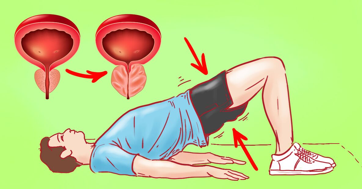 gimnastičke vježbe za prostatitis